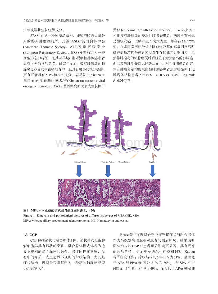 含微乳头及实体亚型的临床早期浸润性肺腺癌研究进展.pdf_第3页