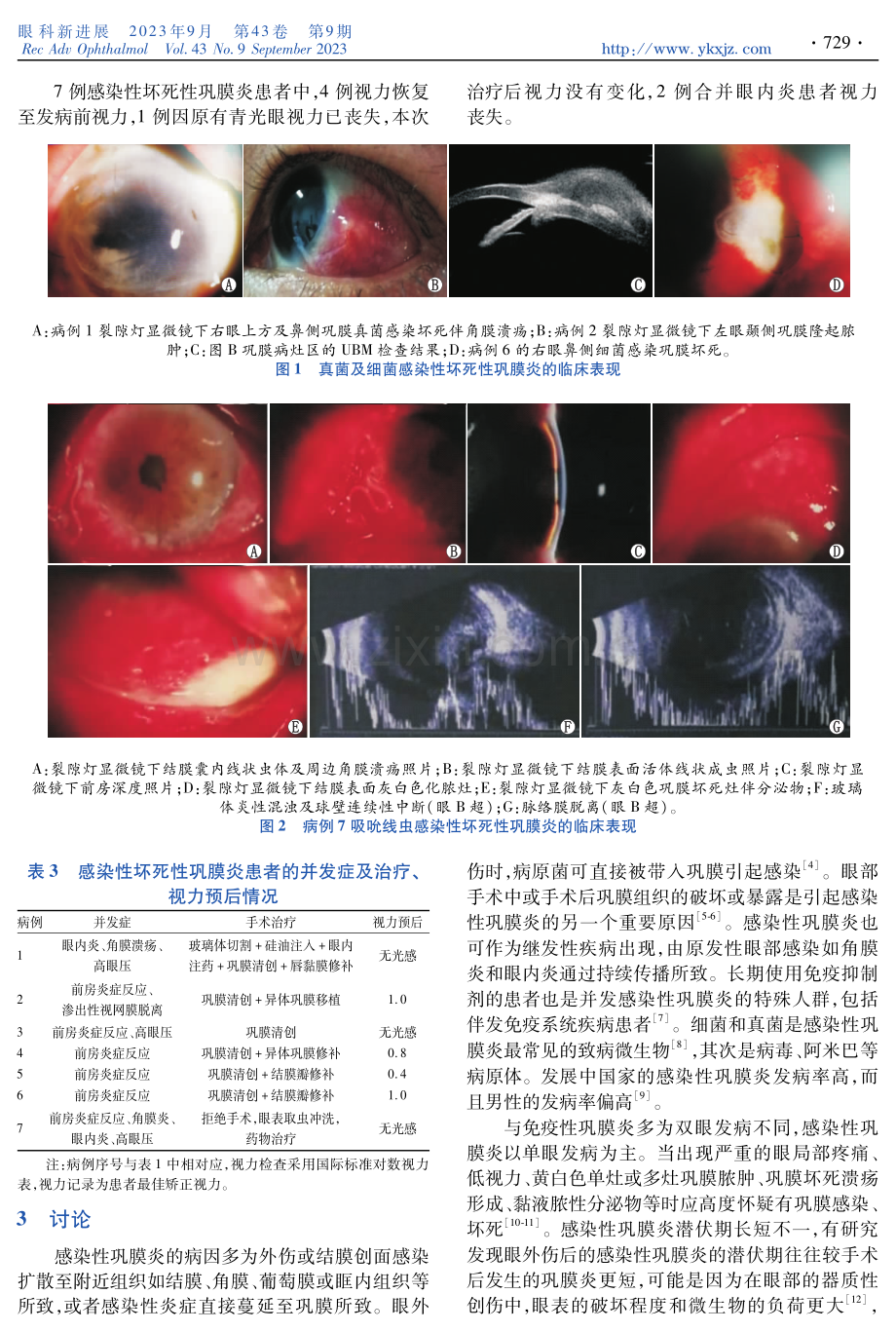 感染性坏死性巩膜炎的临床特点及相关因素分析.pdf_第3页