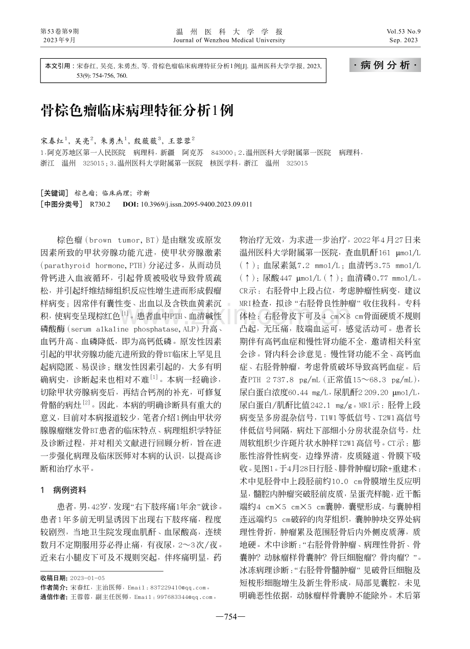 骨棕色瘤临床病理特征分析1例.pdf_第1页