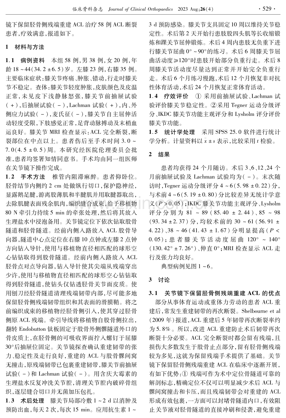 关节镜下保留胫骨侧残端重建前交叉韧带的疗效.pdf_第2页