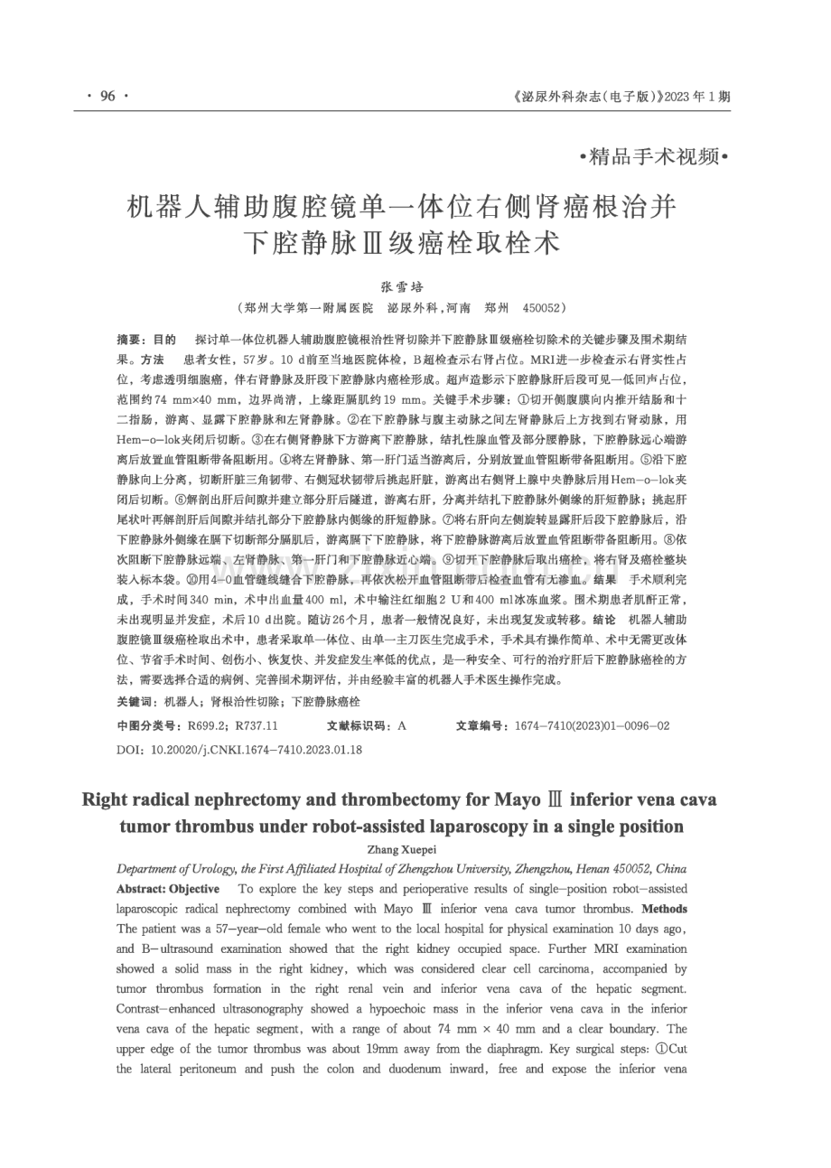 机器人辅助腹腔镜单一体位右侧肾癌根治并下腔静脉Ⅲ级癌栓取栓术.pdf_第1页