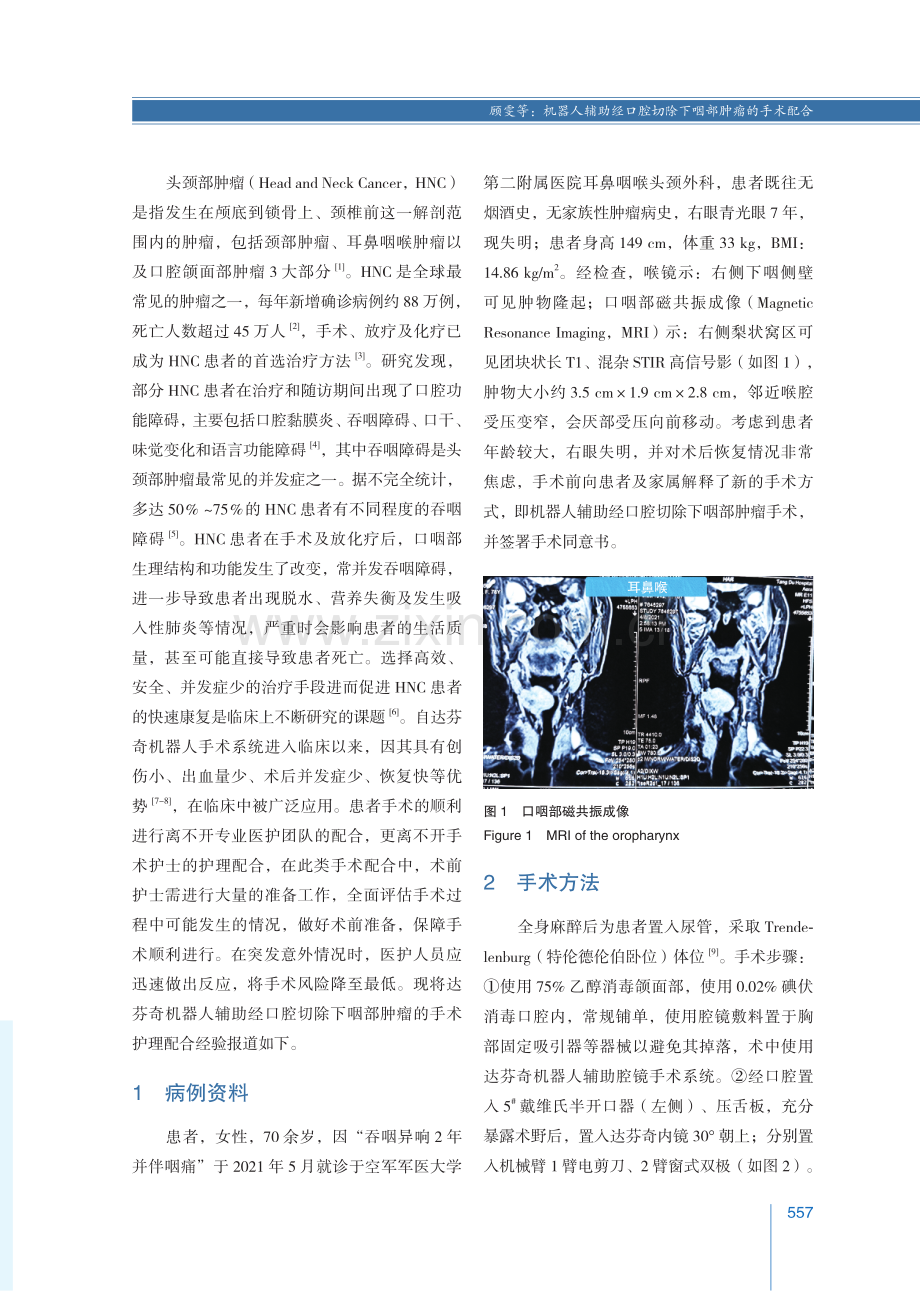 机器人辅助经口腔切除下咽部肿瘤的手术配合.pdf_第2页