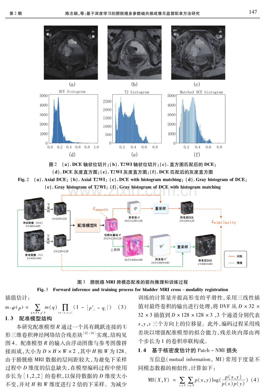 基于深度学习的膀胱癌多参数磁共振成像无监督配准方法研究.pdf_第3页