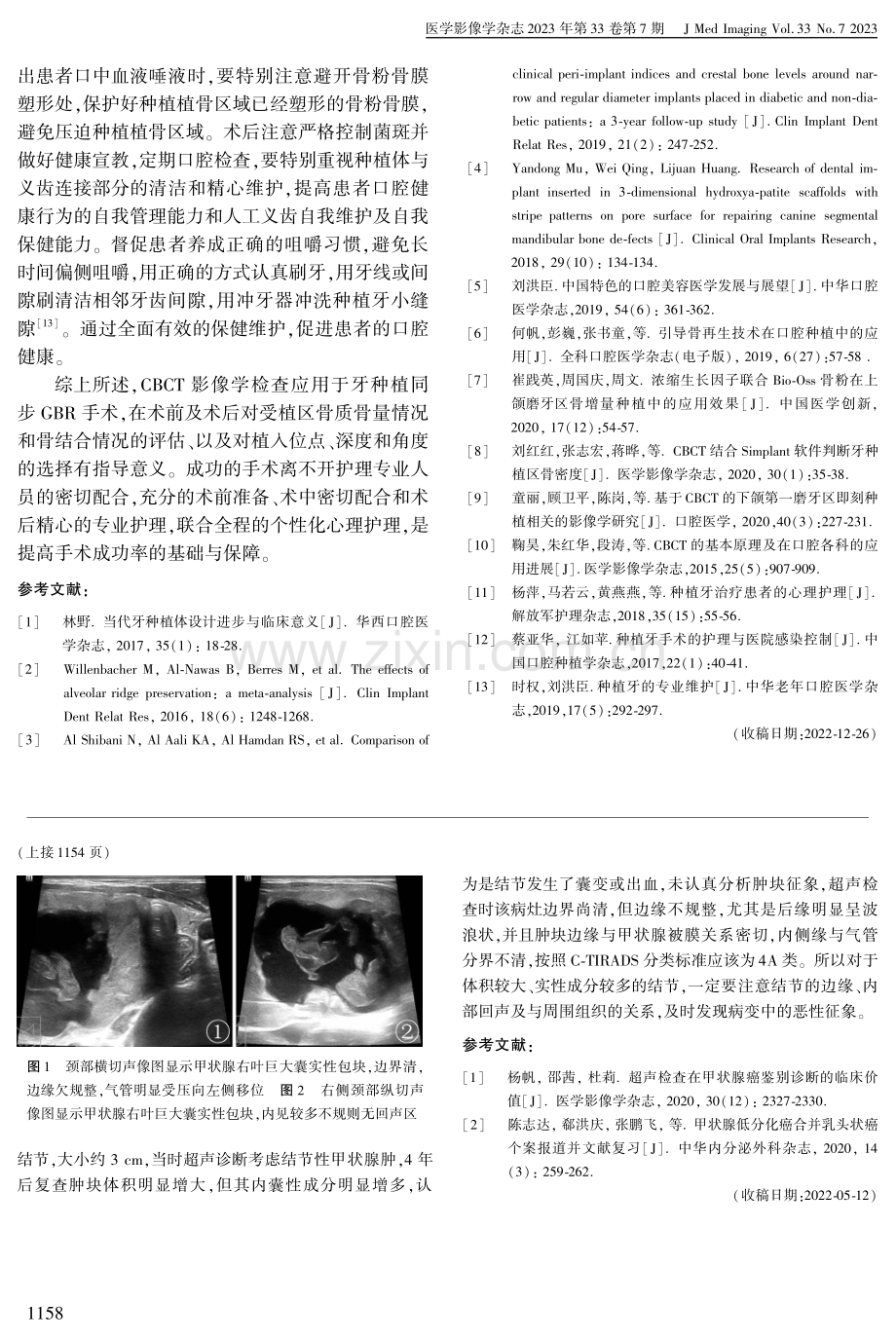 甲状腺低分化癌超声误诊为结节性甲状腺肿1例.pdf_第2页