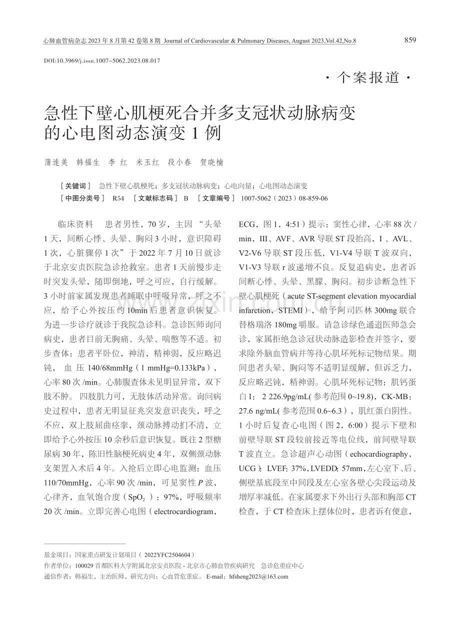 急性下壁心肌梗死合并多支冠状动脉病变的心电图动态演变1例.pdf_第1页