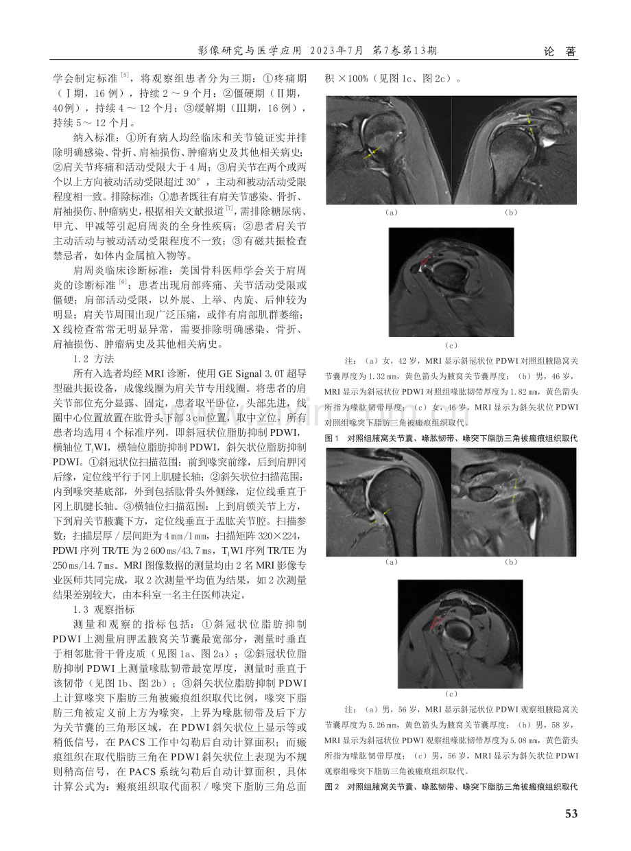 肩周炎MRI征象与其临床分期的关系.pdf_第2页