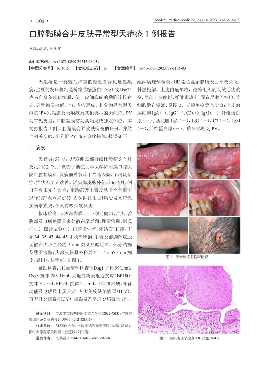 口腔黏膜合并皮肤寻常型天疱疮1例报告.pdf_第1页