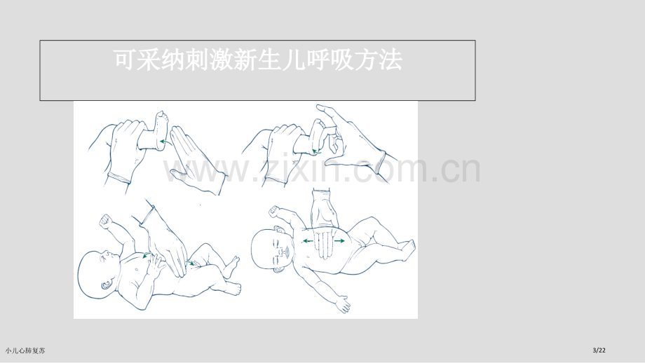 小儿心肺复苏.pptx_第3页