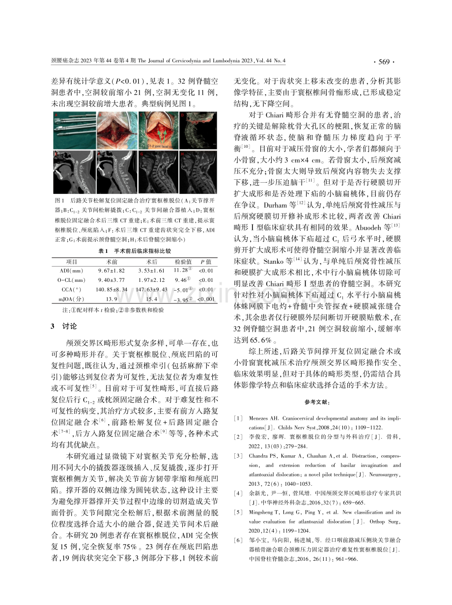 颅颈交界区畸形手术治疗临床疗效分析.pdf_第3页