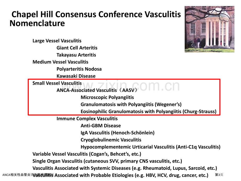 ANCA相关性血管炎肾损害病理表现.pptx_第3页
