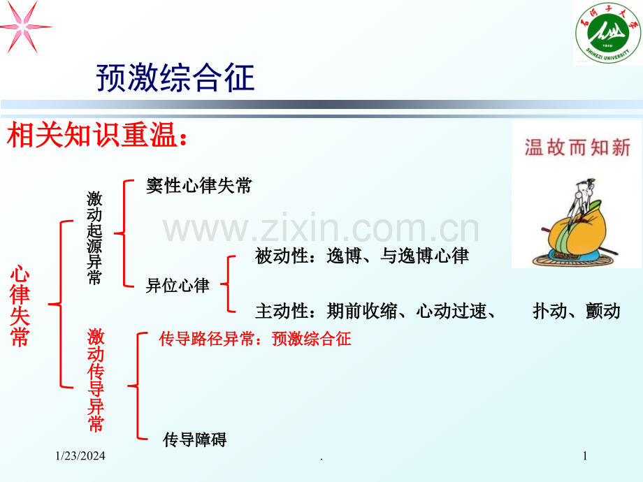 预激综合征PPT课件.ppt_第1页