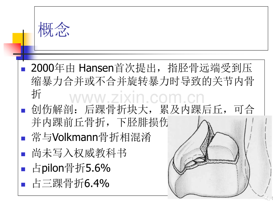 后pilon骨折足踝外科PPT培训课件.ppt_第2页