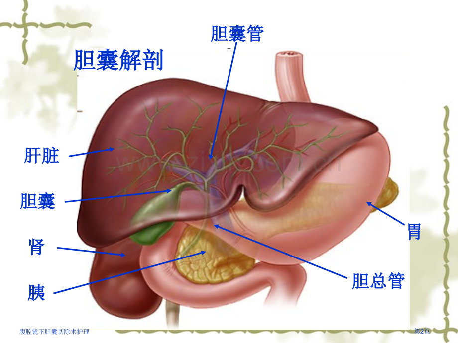 腹腔镜下胆囊切除术护理.pptx_第2页