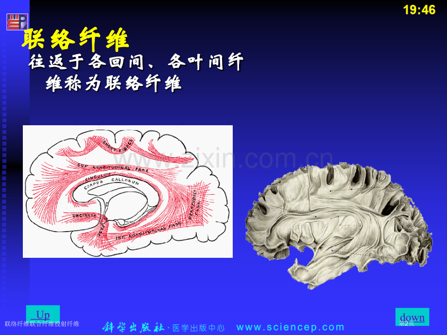 联络纤维联合纤维投射纤维专家讲座.pptx_第2页