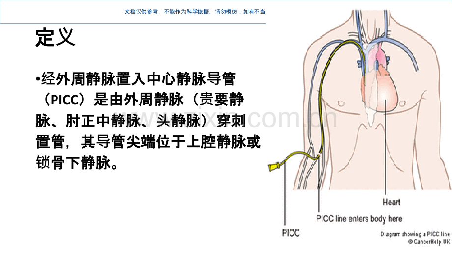 PICC置管后的居家护理课件.ppt_第1页