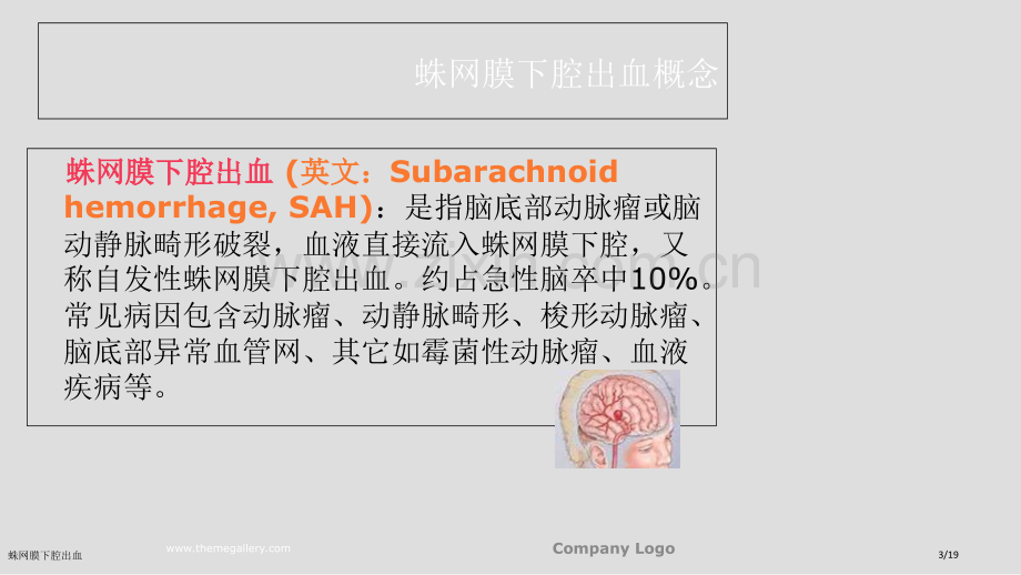 蛛网膜下腔出血.pptx_第3页