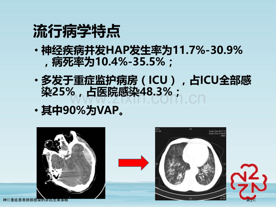 神经重症患者肺部感染的非抗生素策略.pptx_第3页