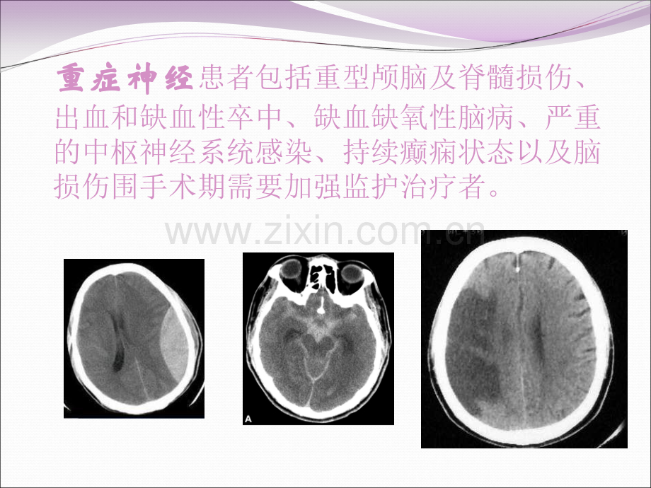 医学重症神经患者的镇静专题课件.ppt_第2页