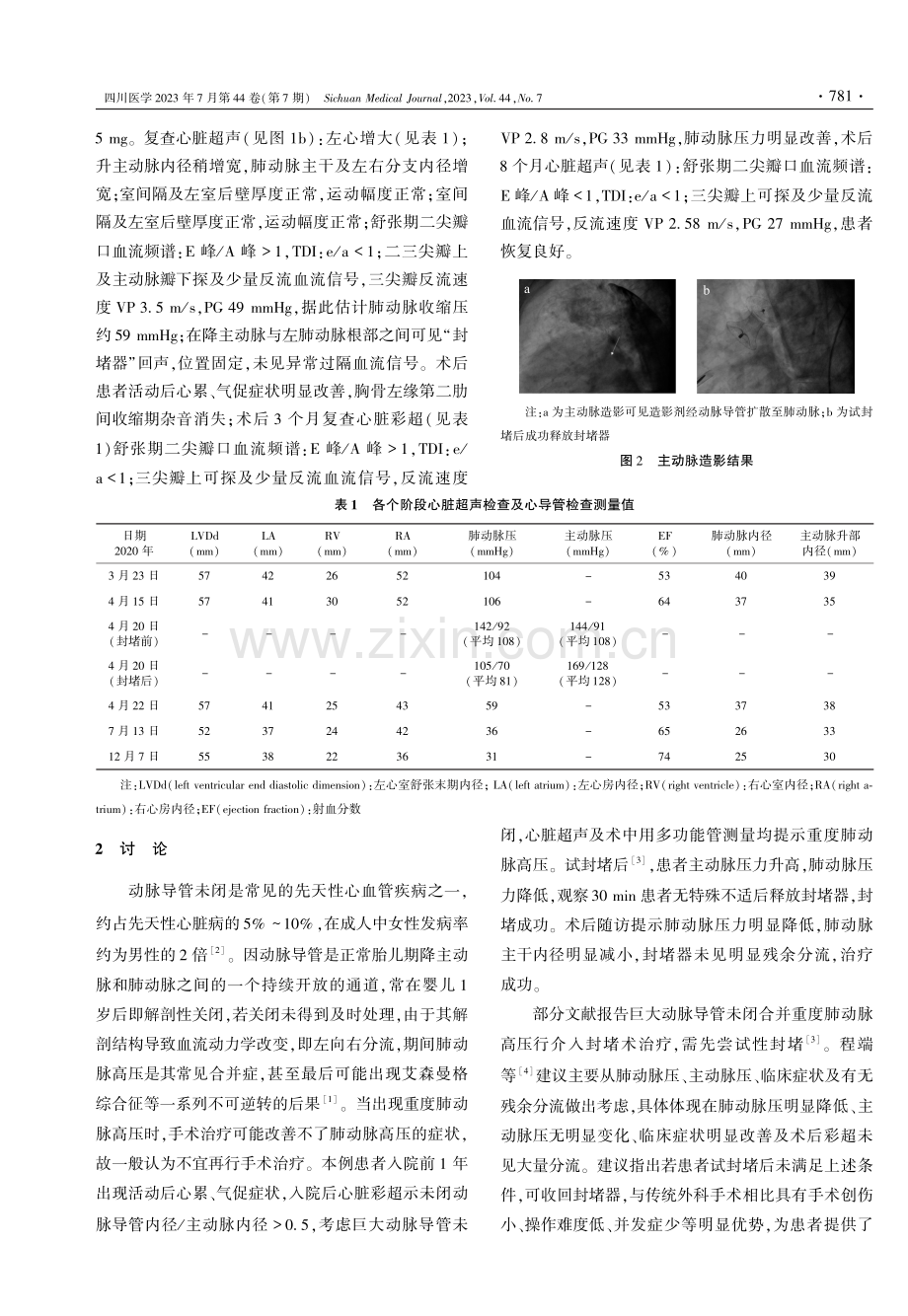 明显心累气促的巨大动脉导管未闭成功封堵1例.pdf_第2页