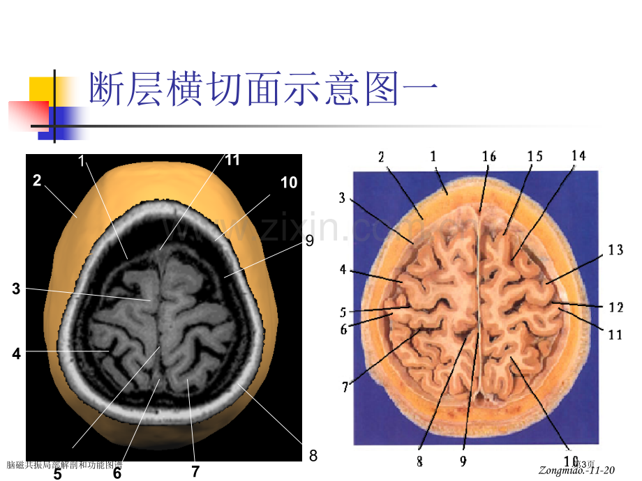 脑磁共振局部解剖和功能图谱.pptx_第3页