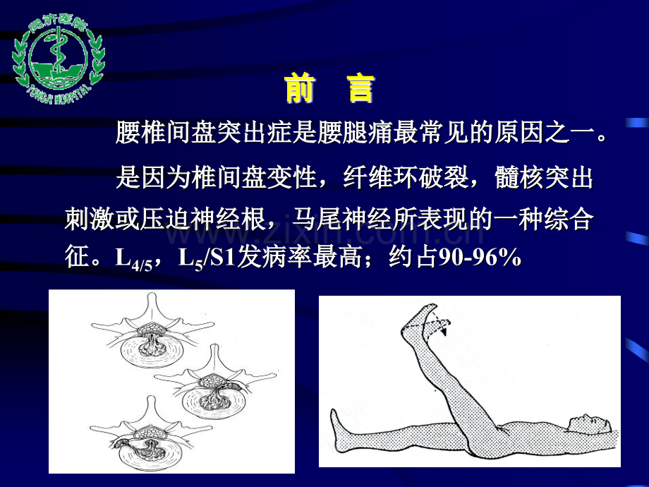 微创手术治疗腰椎间盘突出症(PPT课件).ppt_第2页