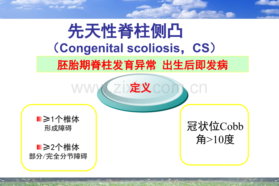 先天性脊柱侧凸的诊疗和治疗讲义.ppt_第2页