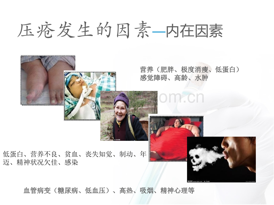 手术室压疮的预防PPT课件.ppt_第3页