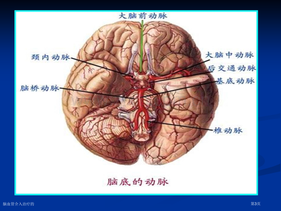 脑血管介入治疗的.pptx_第3页