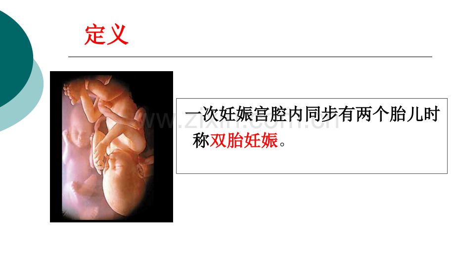 医学双胎妊娠宣教培训课件.pptx_第2页