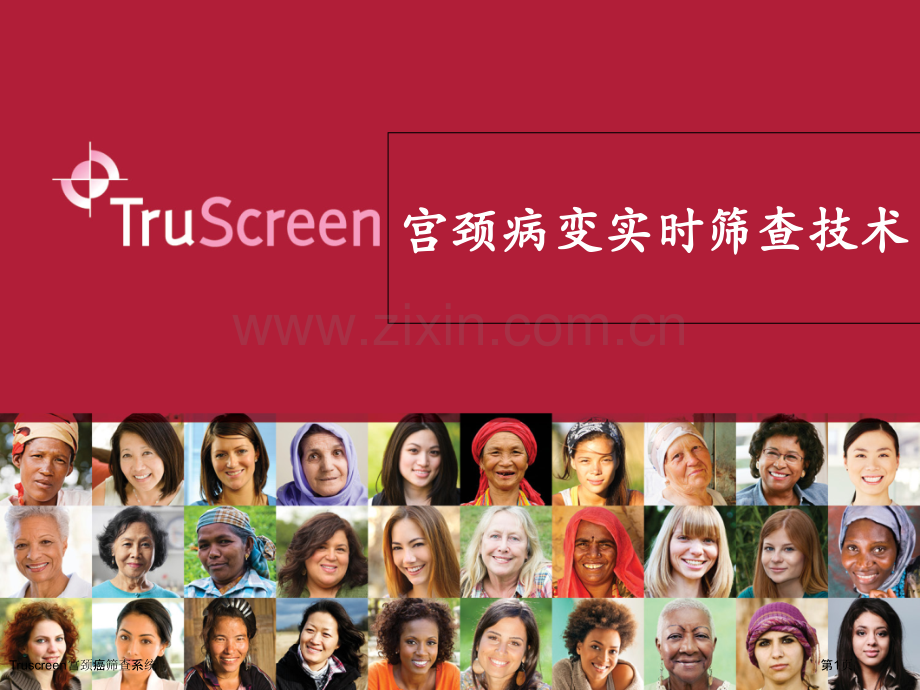 Truscreen宫颈癌筛查系统.pptx_第1页