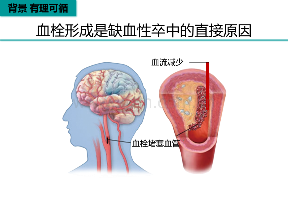 脑梗死再灌注治疗讲义.ppt_第3页