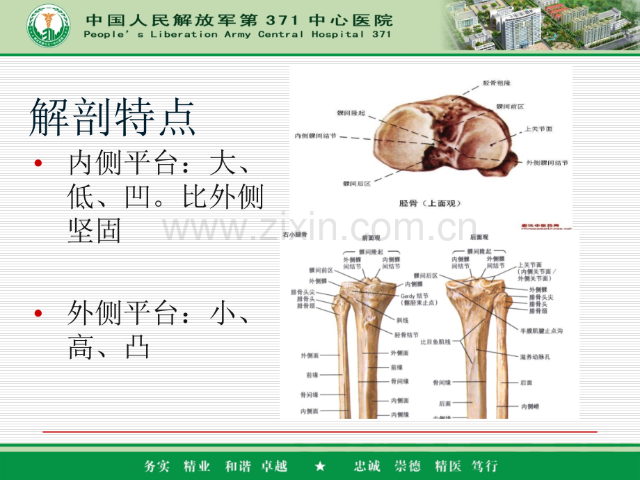 胫骨平台骨折PPT医学课件.ppt_第3页