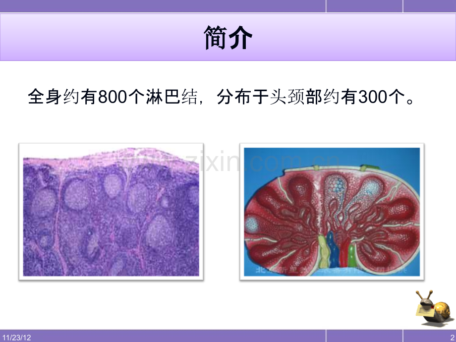 颈部淋巴结病变的CT表现讲义.ppt_第2页