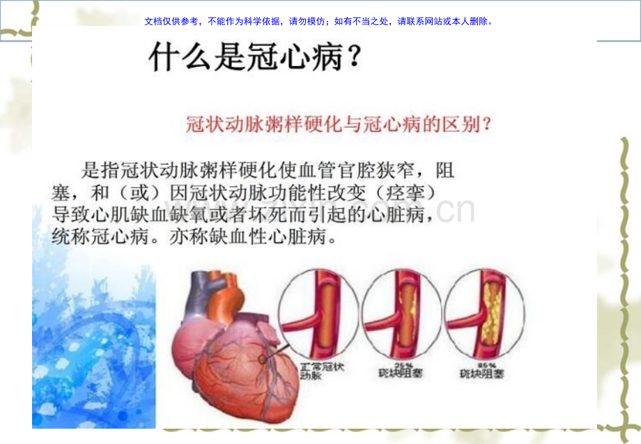 冠状动脉PCI(CAG术的护理课件.pptx_第1页