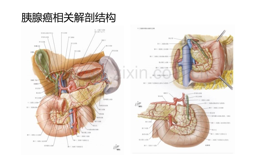 胰十二指肠切除术的术式演变讲义.ppt_第3页