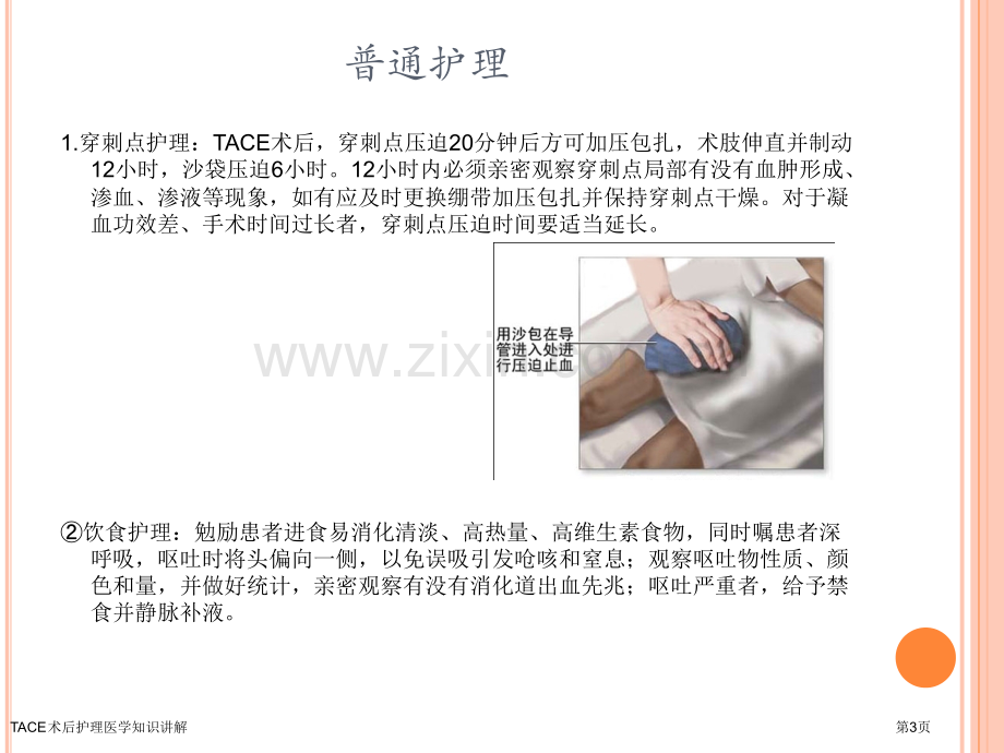 TACE术后护理医学知识讲解.pptx_第3页