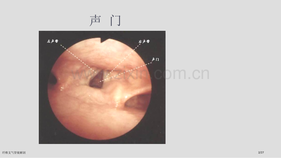 纤维支气管镜解剖.pptx_第2页