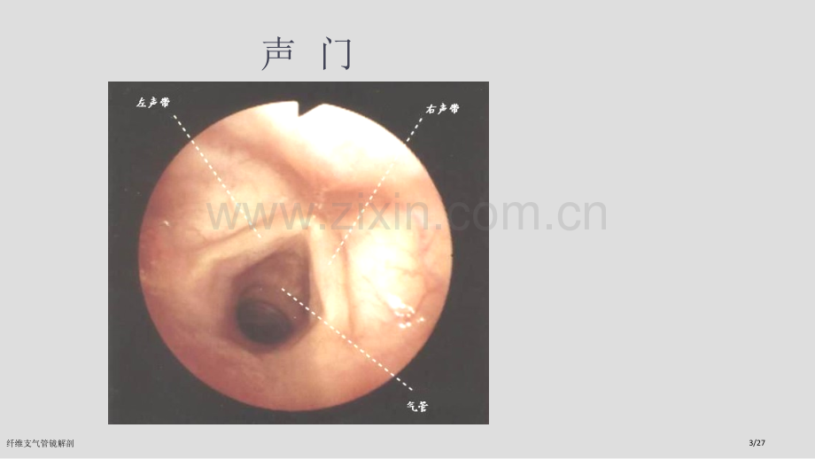 纤维支气管镜解剖.pptx_第3页