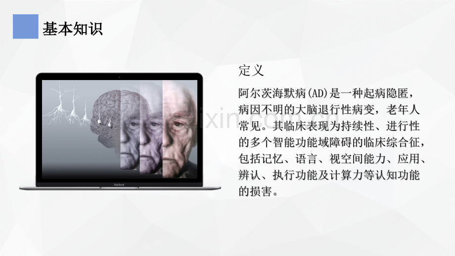 阿尔茨海默症医疗护理查房PPT优质课件.ppt_第3页