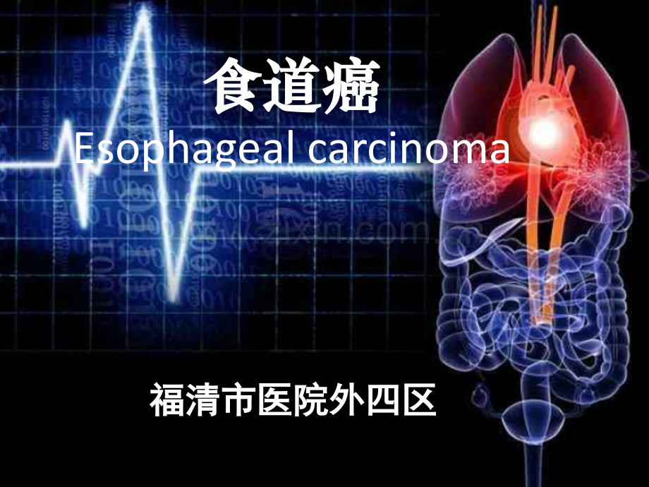 食管癌护理查房PPT课件.ppt_第2页