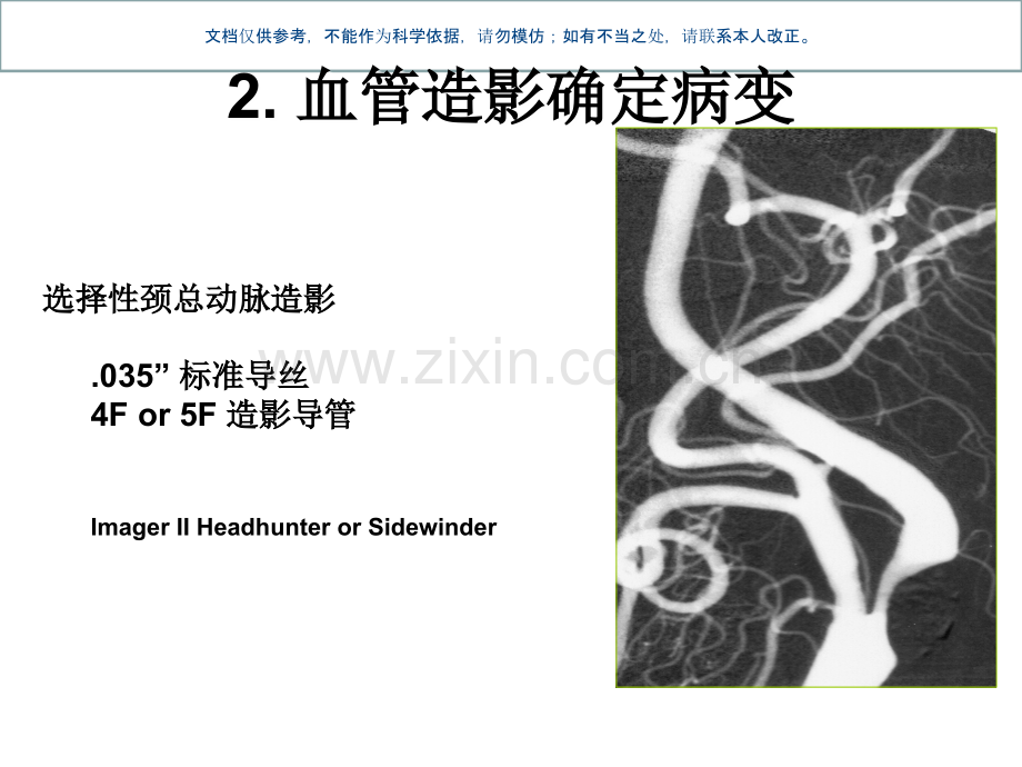 颈动脉支架手术步课件.ppt_第3页