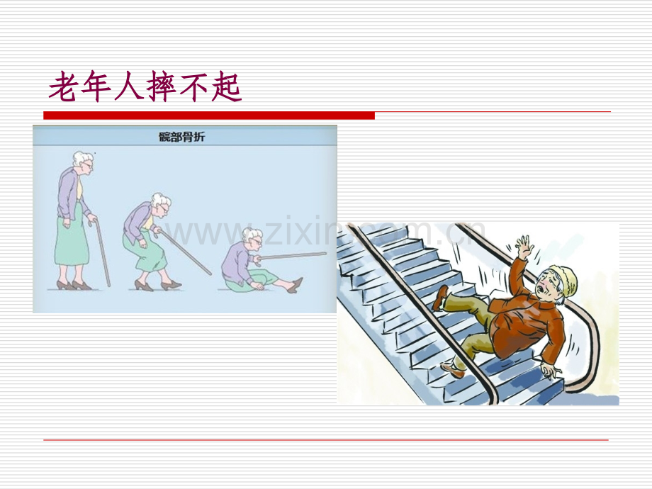 老年髋部骨折PPT课件.ppt_第2页