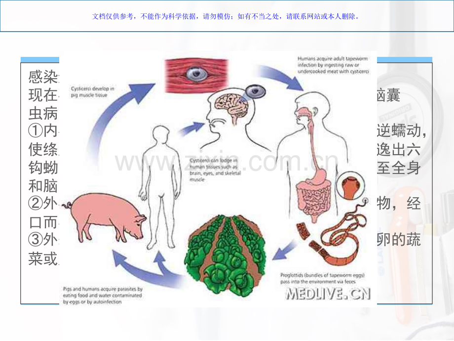 脑囊虫病治疗护理课件.ppt_第3页