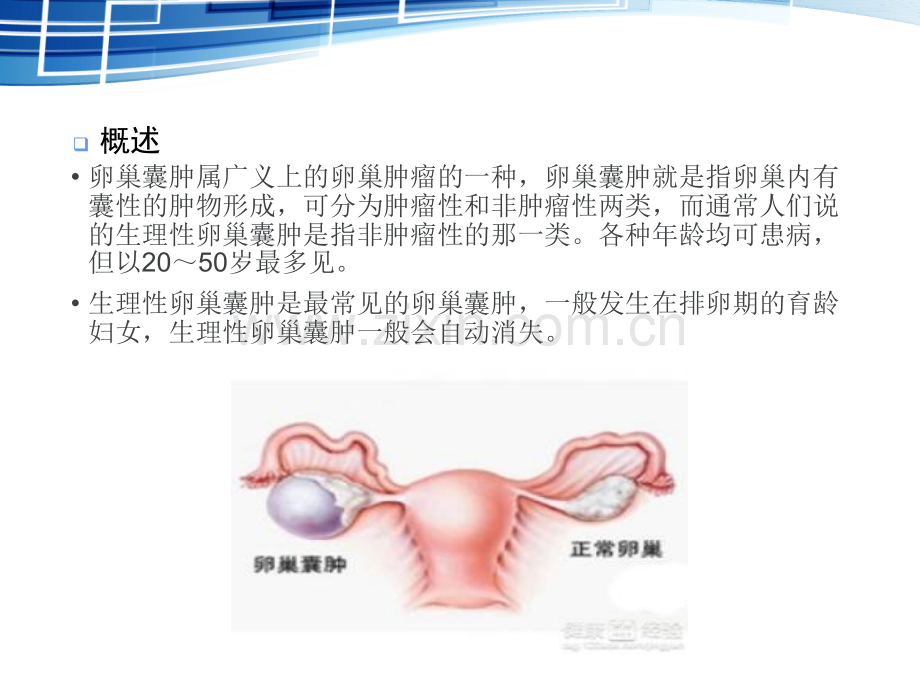 卵巢囊肿PPT课件.ppt_第3页