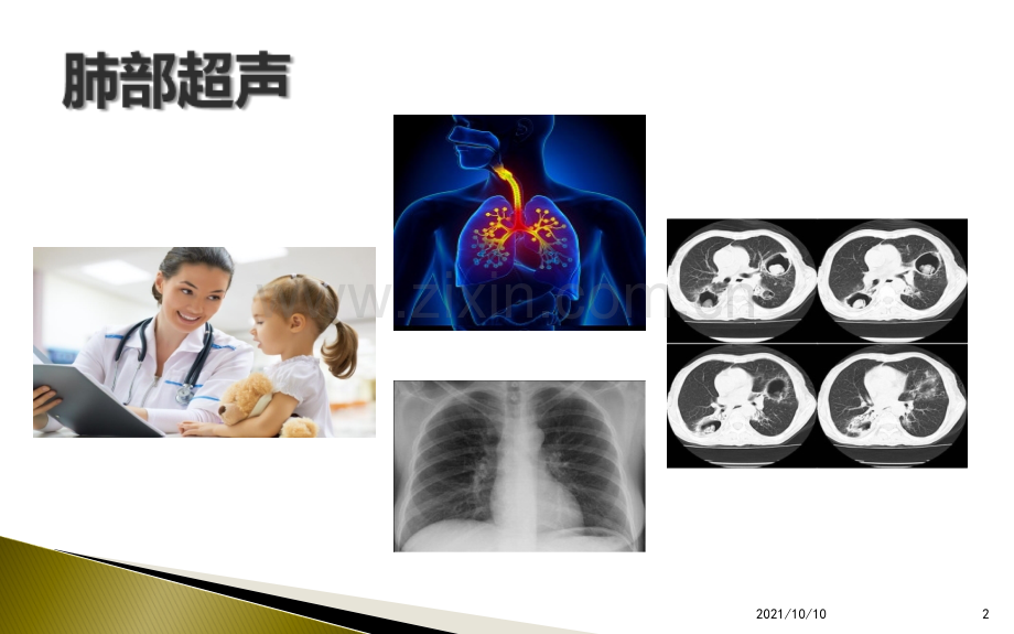 肺部超声的临床应用.ppt_第2页