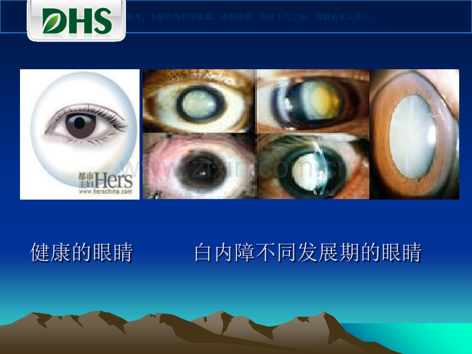 眼健康科普知识课件.ppt_第3页