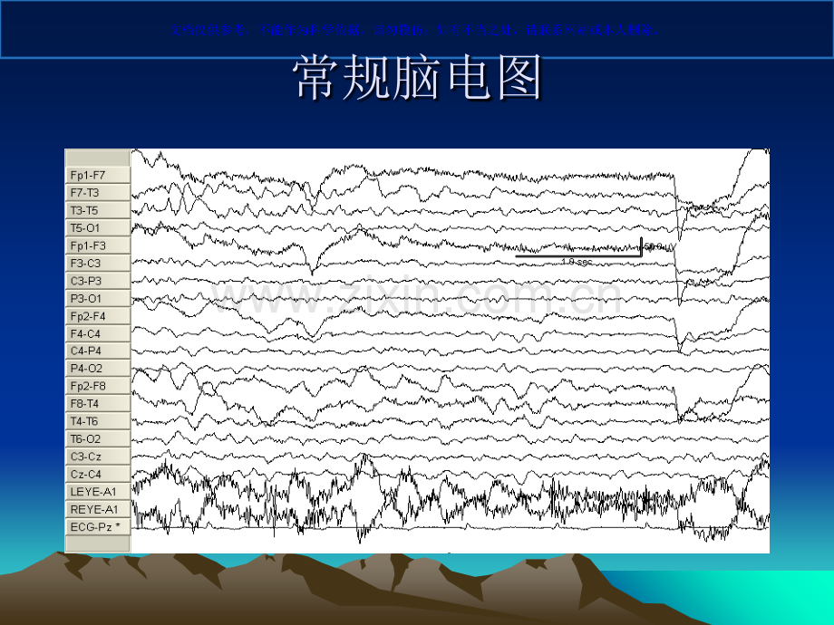 振幅整合脑电图在新生儿的应用课件.ppt_第2页