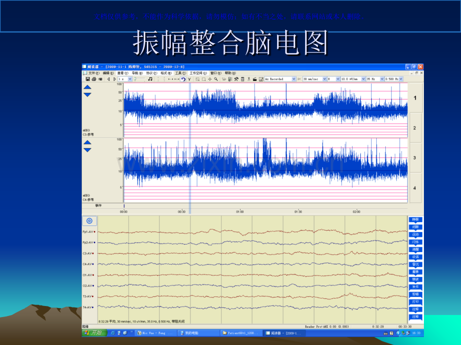 振幅整合脑电图在新生儿的应用课件.ppt_第3页