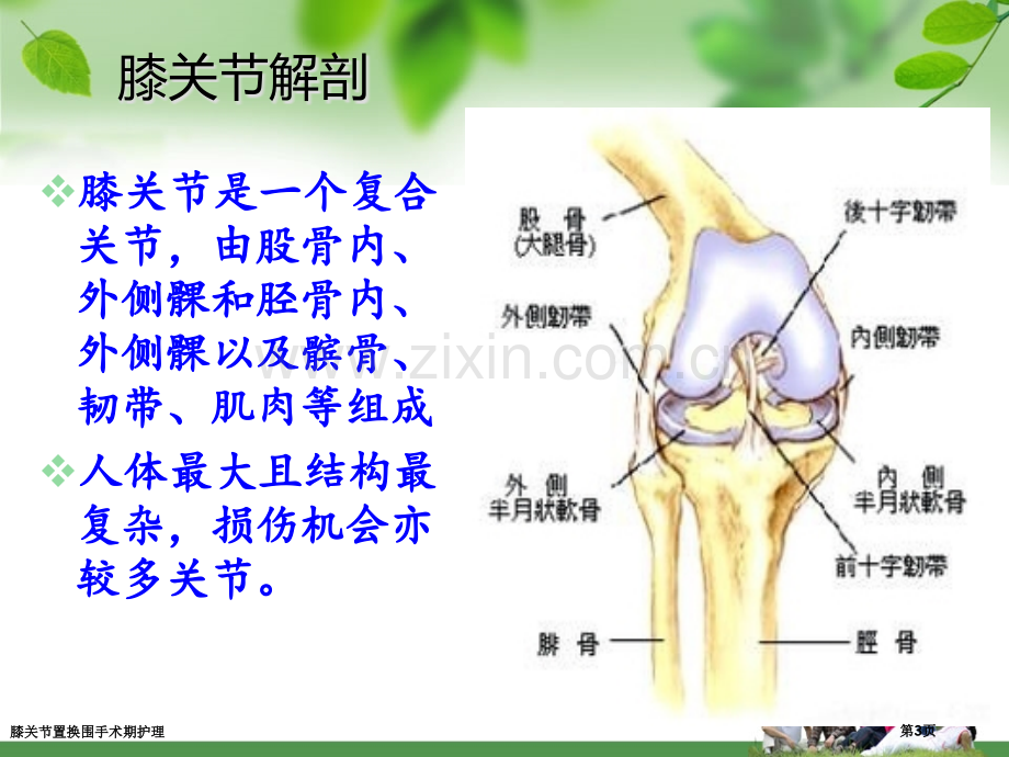 膝关节置换围手术期护理.pptx_第3页