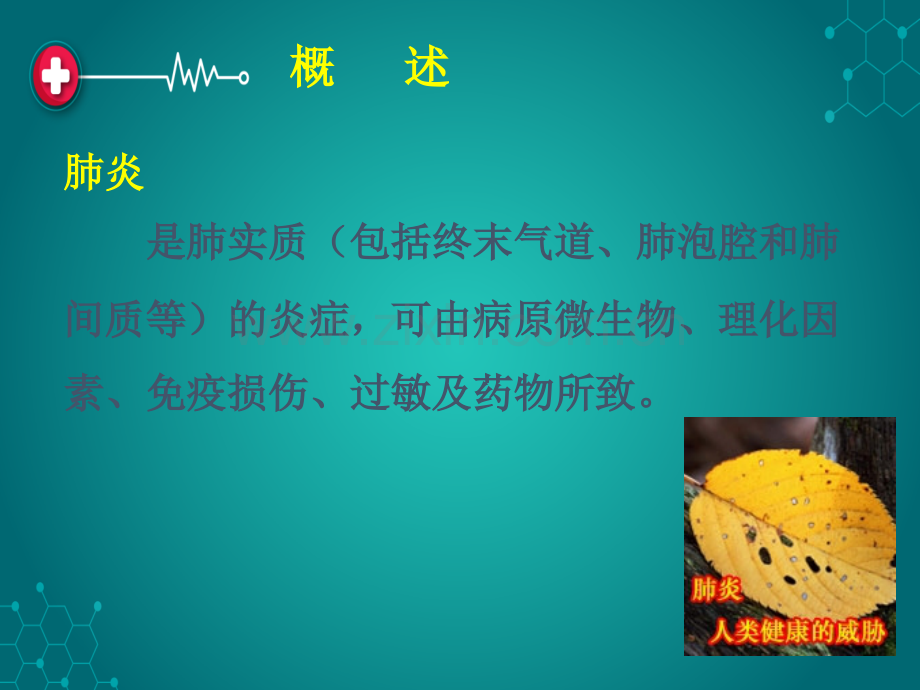 肺--炎ppt课件.ppt_第3页